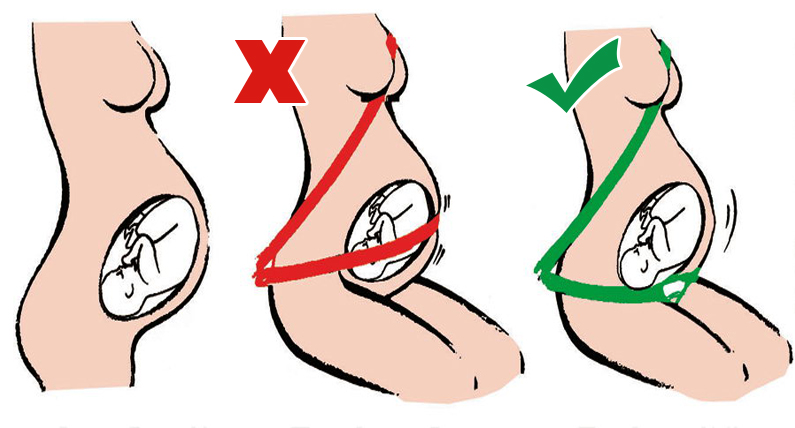 zapinanie_pasów_bezpieczeństwa_w_ciąży_dlaczego_jest_konieczne